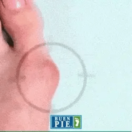 Correctores de Juanetes ComfyFeet
