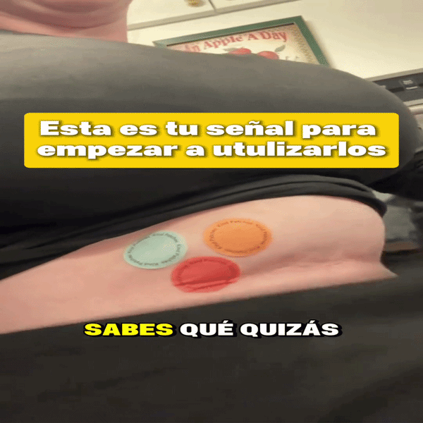 Parches GLP Venett Control Avanzado