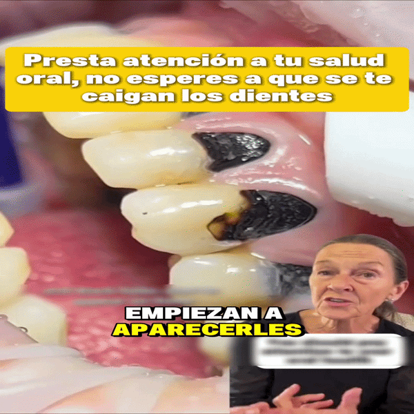 Sonrisa Vital NanoRepair Brillante