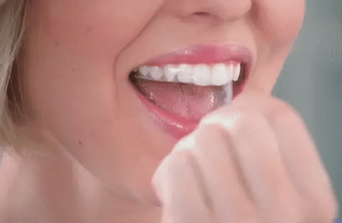 Sonrisa Brillante Eloura Fácil Rápida