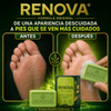 Jabón antimicótico Renova® Formula Original