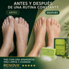 Jabón antimicótico Renova® Formula Original