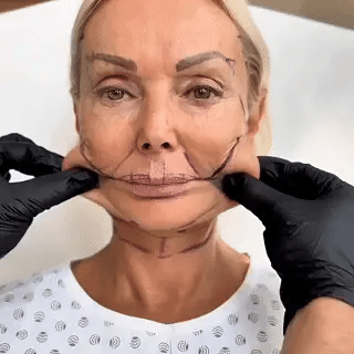 SkinLift Tonificador Facial