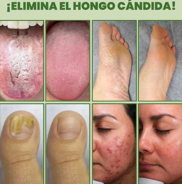 Aceite de Orégano Puro Salud