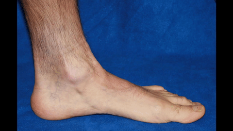 Alivio Neural Total Avanzado Plus