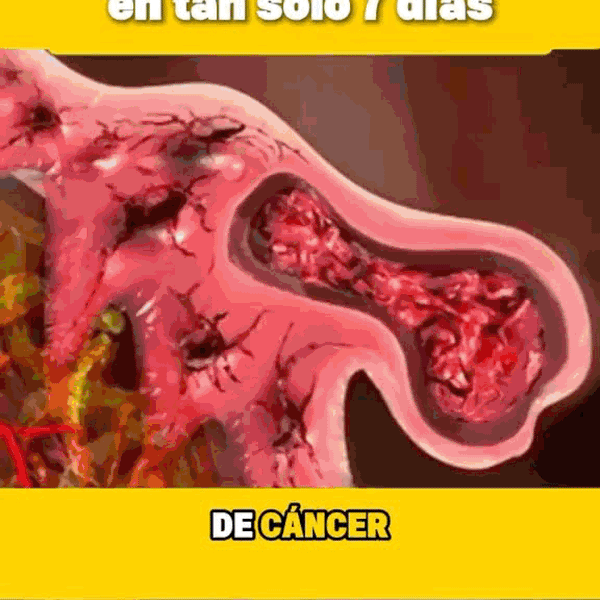 Gel Fresco para Alivio
