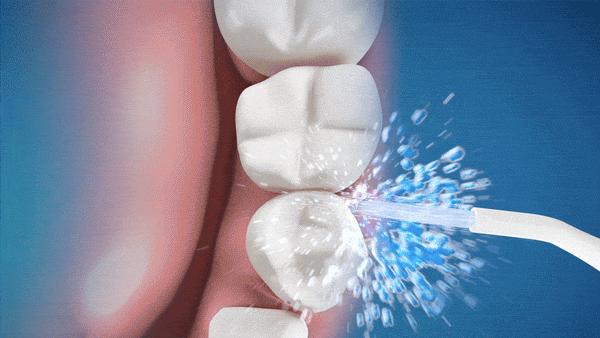 AquaClean Duo Irrigador Dental Portátil