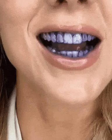 Suero Corrector V para Sonrisa Radiante