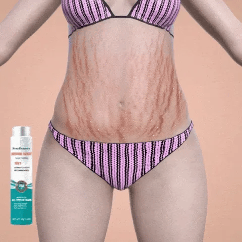 Gel Milagroso para Cicatrices