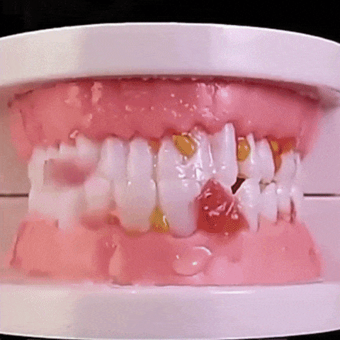 Irrigador Limpieza Dental