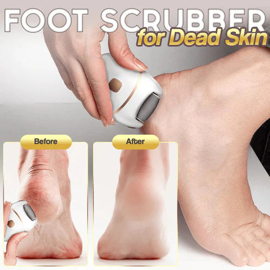 Foot Scrubber - Removedor de callos