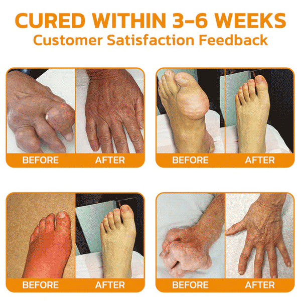 Alivio Articular Veneno de Abeja